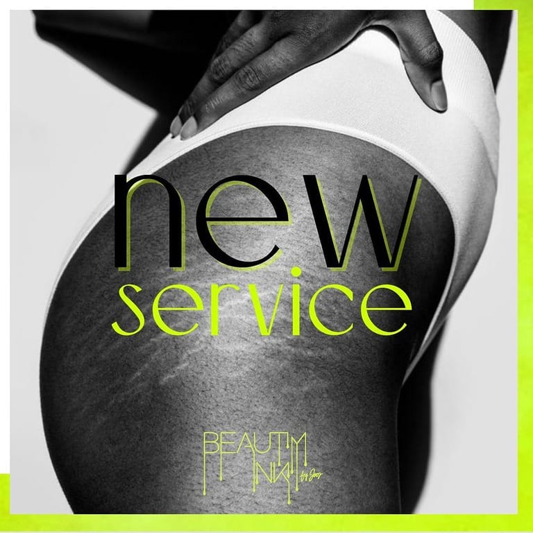 Close-up of stretch-marked torso with text overlay.